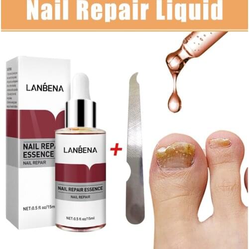 Fungal Nail Treatments Liquid Nourishing Bright Finger Toe Repair Serum Remove Onychomycosis Fungus Nails Care 12ml TSLM1