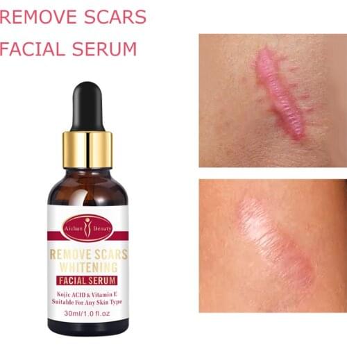 Removal Scar Serum Face Pimples Scar Stretch Marks Removal Acne Treatment Moisturizing Repair Skin Care Essence Liquid 30ml