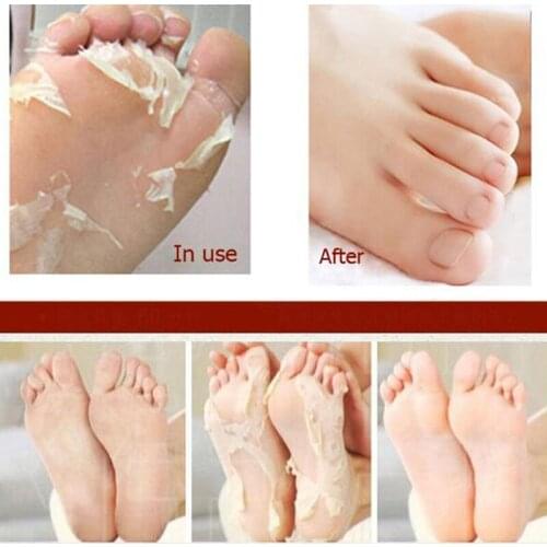 1pair Foot Peeling Mask Pedicure Socks Foot Cream for Heels Exfoliating Feet Mask Exfoliation Peel Socks for Legs