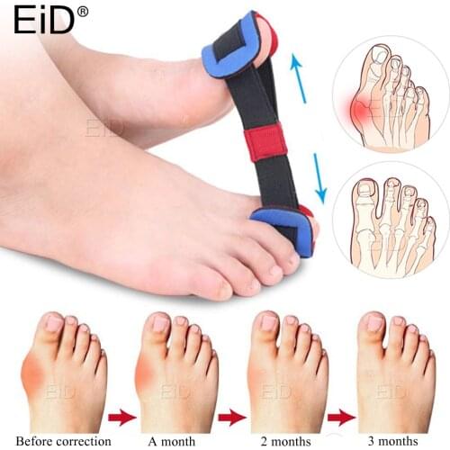 EiD Nylon Bunion Corrector Pad Stretcher Hallux Valgus Protector Guard Toe Separator Orthopedic Straightener Foot Care Unisex