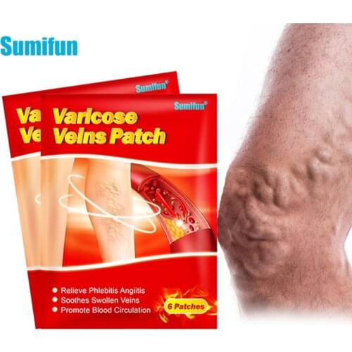 6pcs/bag Sumifun Chinese Varicose Veins Plaster Vasculitis Phlebitis Spider Leg Medical Patch Angiitis Removal Patches