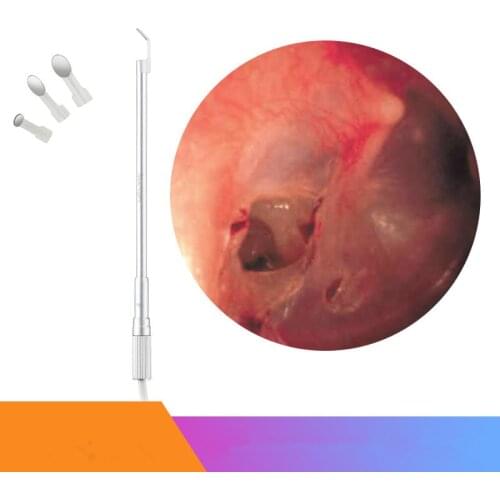 Oral inspection mirror Ear speculum Endoscope USB electron microscope Ear canal examination Nasal detection home Borescopes