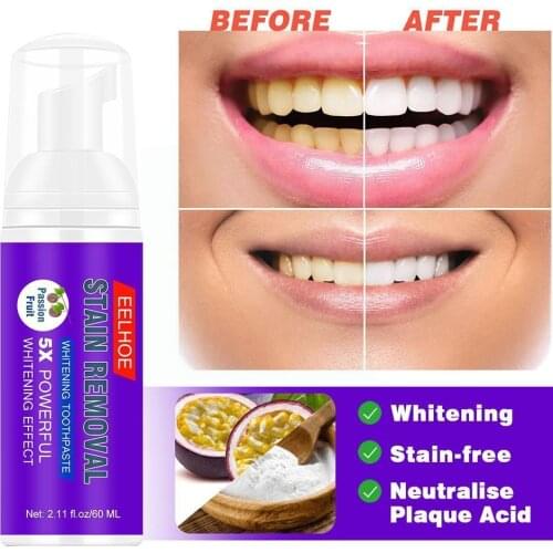 Fruity Foam Toothpaste Baking Soda Toothpaste Remove Toothpaste Breath Gums Fresh Put Stains Whitening Out And S8X7