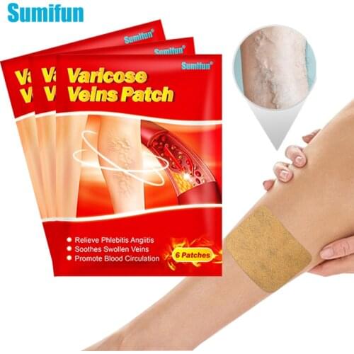 18pcs Sumifun Chinese Varicose Veins Plaster Vasculitis Phlebitis Spider Leg Medical Patch Angiitis Removal Patches Health Care
