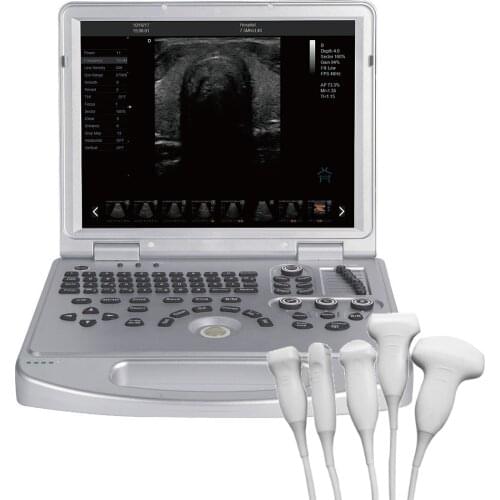 Запчасти для инструментов SENAVILLA China At AliExpress