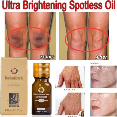 Ultra Brightening Spotless Oil Skin Care Dark Spots Remove Ance Burn Strentch Marks Scar Removal Brighten Essence 10ml