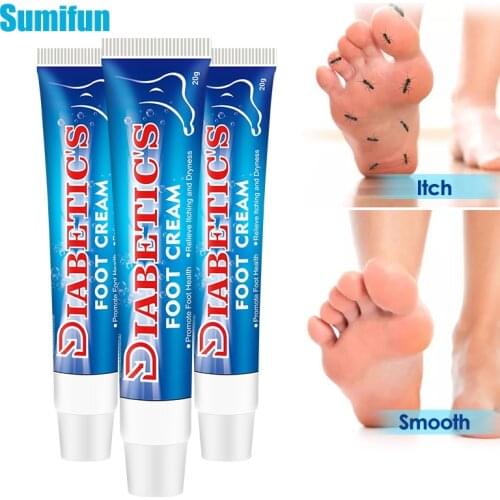 3pcs Sumifun Diabetes Foot Treatment Cream Anti Inflammation Diabetic Foot Ulceration Cream Itch Relief Moisturizing Skin Care