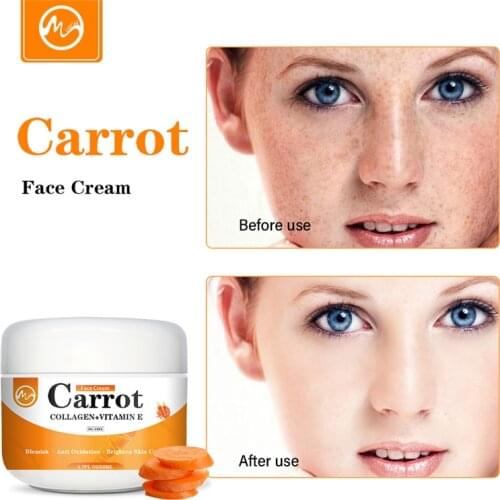 Minch Carrot Face Cream Dark Spot Corrector Face Whitening Cream Brighten Blemish Freckle Remover Women Natural Korea Skin Care