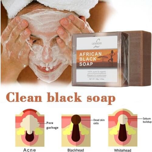 African Black Soap Magic Anti Rebelles Beauty Moisturizing Skin Shea Care Body Bath Natural Treatment Acne Butter M8Z1