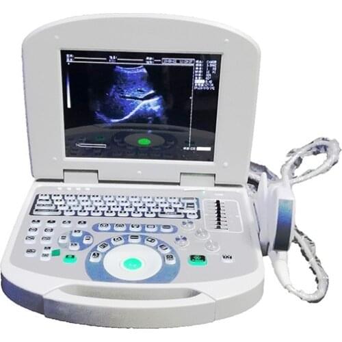 S-810 Portable Ultrasound scanner