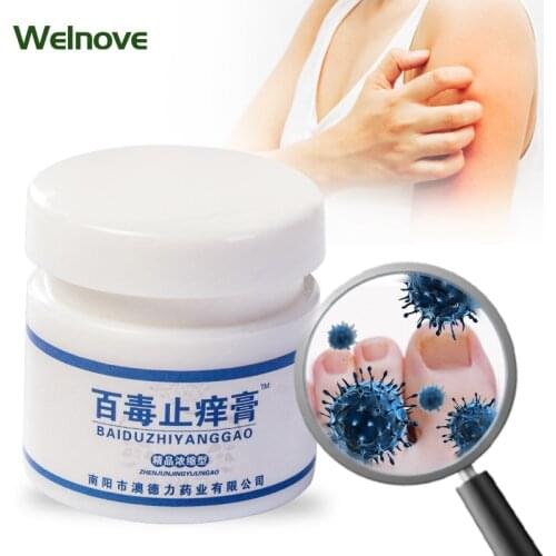 1Pcs Psoriasis Antibacterial Ointment Herbal Medical Ointment Itchy Skin Treatment Ointment Psoriasis Dermatitis Pruritus Cream