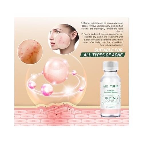 29ml effective Acne Treatment Mario Badescu Drying Lotion 29ml Anti Acne Serum Pimple Blemish Removal skin care products