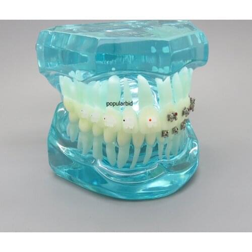 Dental Orthodontics model 4 Types of Brackets Communication Model Dentist Patient Communication Teeth Model