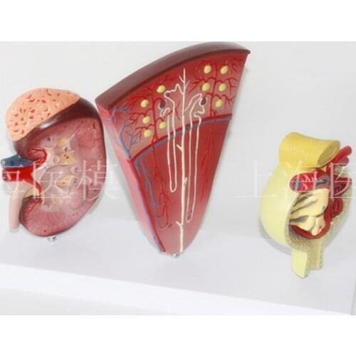 3 pcs Kidney and Urinary System Model nephron model glomerular renal anatomy model Kidney cross section