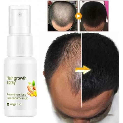 20ml Ginger Herbal Hair Scalp Treatments Health Strong Strength Growth Hair Liquid Treatment Spray
