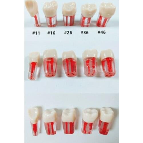 25Pis/lot(5Pis of each position) Dental Endo Root Canal Pulp Files Practise Blocks Study Model #11 #16 #26 #36 #46 5Sizes