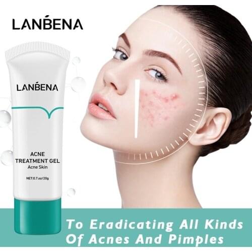 LANBENA Acne Treatment Cream Remove Blackheads Pimples Gel Face Clean Effective Fade Marks Scars Refreshing Repair Damaged Skin