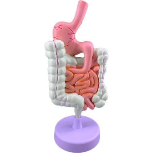 Colonic pathology model gastrointestinal model colorectal lesion model intestinal disease human colonic lesion model