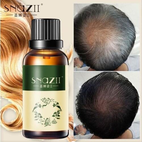 Fast Powerful Hair Growth Essence Hair Care Essential Oils Treatment For Men And Women Hair Loss Serum Repair Hair root 30ml