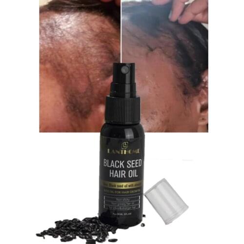 Средства для роста волос DJBS China At AliExpress