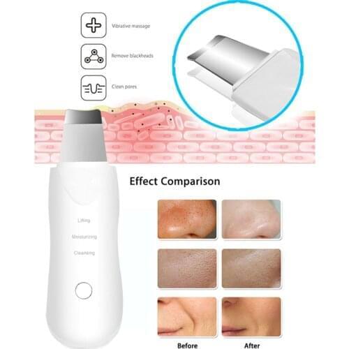 Rechargeable Skin Scrubber Vibration Massage Deep Face Cleaning Remove Dirt Blackhead Facial Machine Not Ultrasonic Device