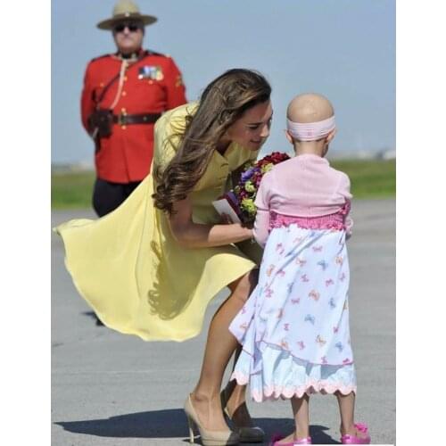 Yellow Solid Kate Middleton Princess Dres Fashion Button Design Short Sleeve Pleated Dreses