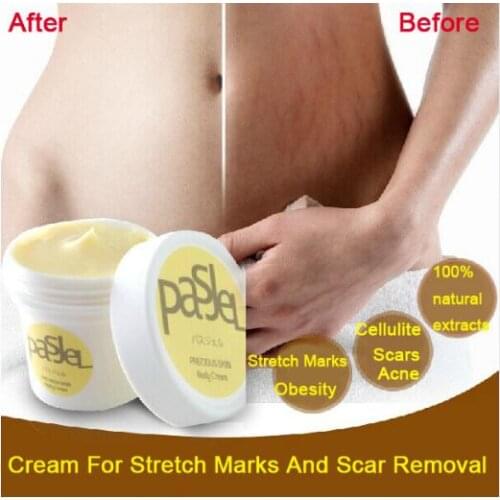 New Arrival Hamile Maternidad Pasjel Cream For Stretch Marks And Scar Removal Powerful To Maternity Skin Body Repair