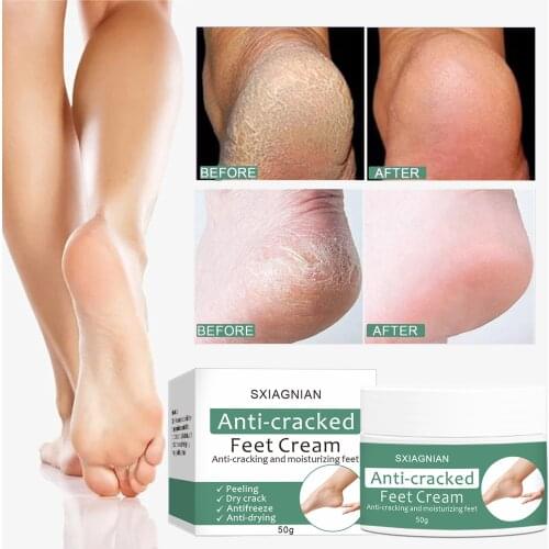 MLINYNILO Foot Care Products