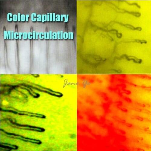 Hot Sale! Nailfold Video Capillaroscope Detection Instrument Microcirculation Microscope With CE