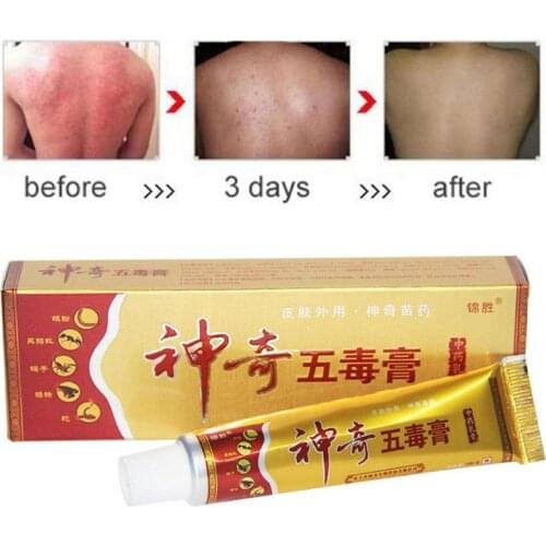 15g Herbal Psoriasis Treatment Cream Psoriasis Ointment Dermatitis Eczematoid Eczema Ointment Skin Treatment Anti-itching Cream