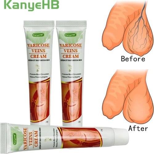 3pcs Genital Scrotum Varicocele Remover Treatment Varicose Veins Cream Varicosity Angiitis Phlebitis Leg Veins Pain Removal A641