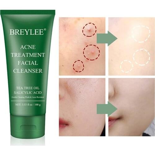 Tea Tree Oil Acne Treatment Face Cleaser Salicylic Acid Remove Aged Cutin Smooth Skin Deep Clean Makeup Remains Anti Blackhead