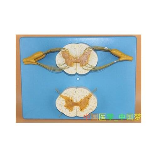 5X Spinal cord and spinal nerve branches amplification model Medical Teaching free shipping