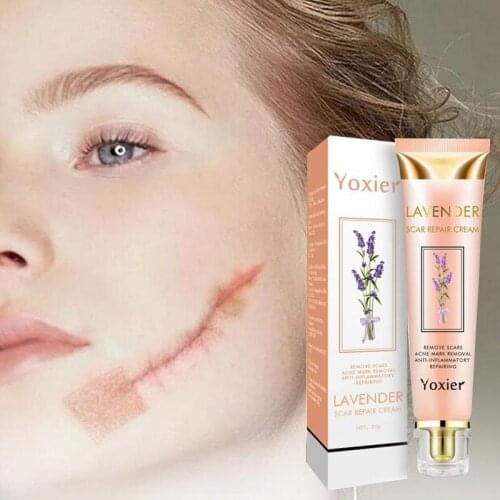 20g Repair Scar Cream Acne Scar Stretch Marks Skin Care Pigmentation Corrector Anti-allergic Calm Whitening Face Cream 1pcs