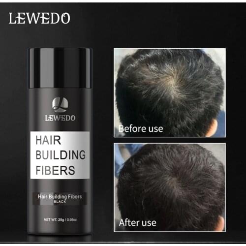 Hair Loss Remedies LEWEDO China