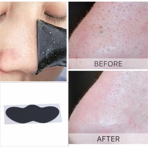 10Pcs Blackhead Mask Black Mask For Face Nose Remove Blackhead Peeling Mask Pore Strip Cleanser Blackhead Mask For Skin Care