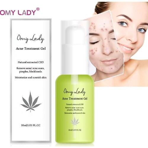 OMY LADY CBD Acne Treatment Face Serum Blackhead Remove Anti Acne Cream Oil Control Shrink Pores Acne Scar Remove Skin Whitening