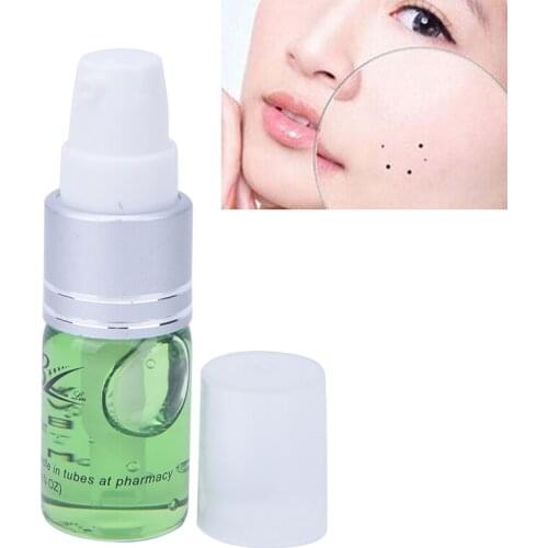Freckle Repair Cream Oil Mole & Skin Tag Repair Solution Painless Mole Skin Dark Spot Repair Face Wart Tag