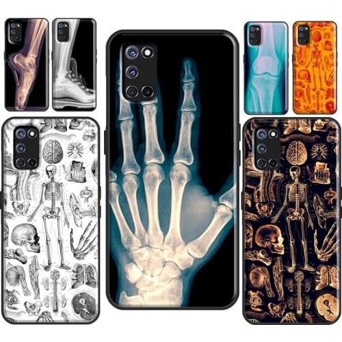 X-Ray Human Anatomy For OPPO Find X2 X3 Pro A1K A3S A5S A15 A52 A72 A83 A91 F7 A53 A31 A9 A5 2020 Phone Case