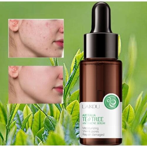 Repairing Face Serum 15ml Tea Tree Essence Fades Acne Mark Facial Serum Relieve The Redness Sensitive Skin Care