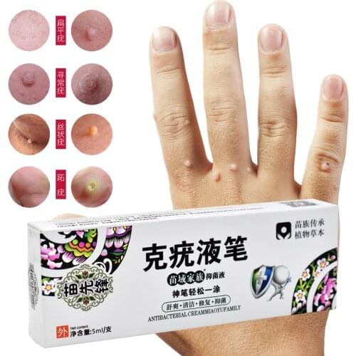5ml Ultra Strength Skin Tag Remover 12 hours Tu kill Medical Tu kill Remover Foot Corn Skin Tag Mole & Genital Wart Remover