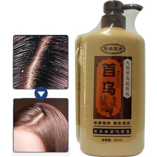 Professional Natural Chinese Medicine Extract Hair Shampoo Nourishing Anti Hair Loss Dandruff Shampoo Hair Care Products 625ML