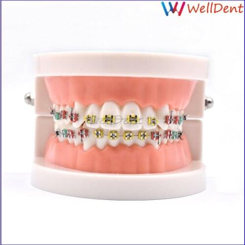 Dental Hoop Model Metal Brackets Ligature Tie Orthodontic Teeth Adult Standard with Brackets Tooth