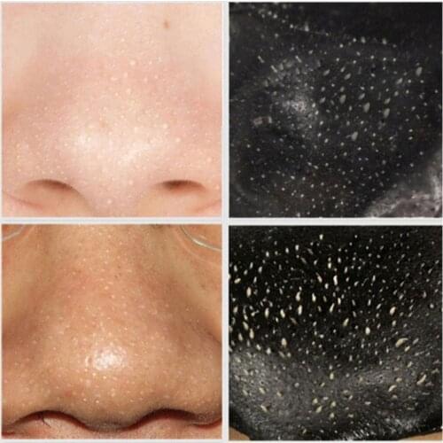 Black Head Mask Volcanic Mud Dead Skin Remove Shrink Black Suck Pull Pores Acne Film Dropship Nose Mask Type Spot Head B6K8