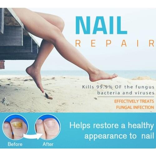 Y1UF 1Pc Fungal Removal Toe Nail Infection Treatment Pen Gel Essence Bright Pencil Feet Care Anti Fungus Biological Repair Tool