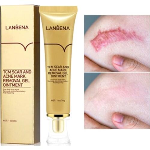 LANBENA Acne Scar Removal Cream Cosmetics For Face Screm Herbal Repair Stretch Marks Remove Scar Treatment Bioaqua Skin Care