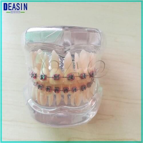 Dental Ortho Metal Bracket clear Demonstration Simulation transparency Dentist Dental Study Teach Teeth Model