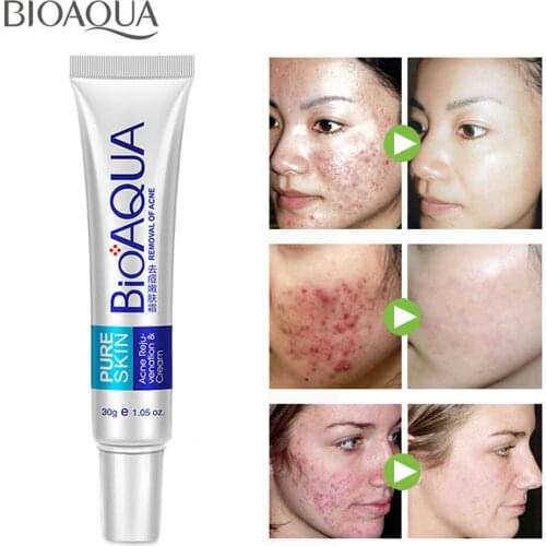 BIOAQUA Anti Acne Set Face Cream Facial Serum Oil Control