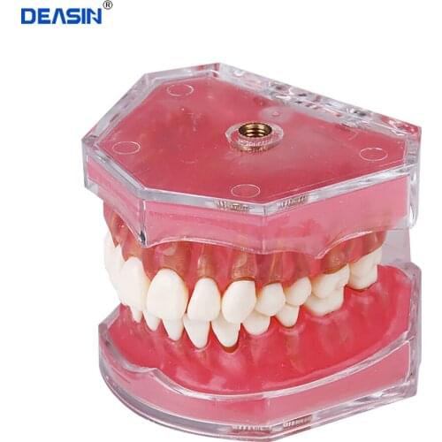 Dental Standard Model with Removable Teeth Dental Study Teach Teeth Model