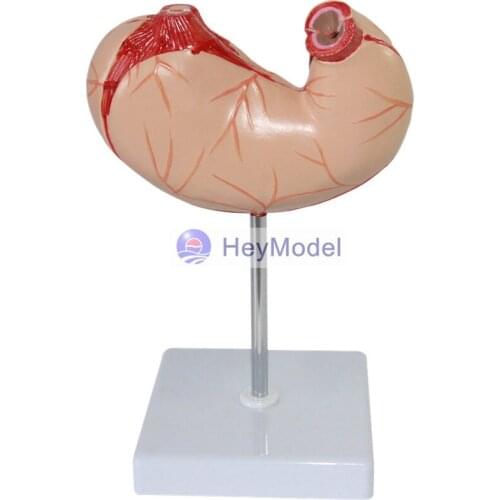 Heymodel Stomach Anatomy Model 2 Parts